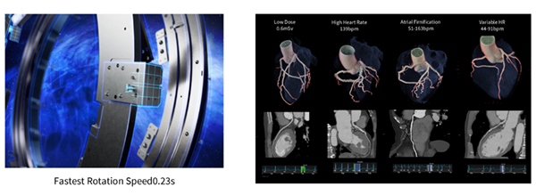 0.23 sec Rotation Time