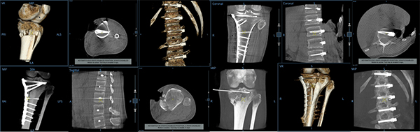 高画質・低線量撮影
