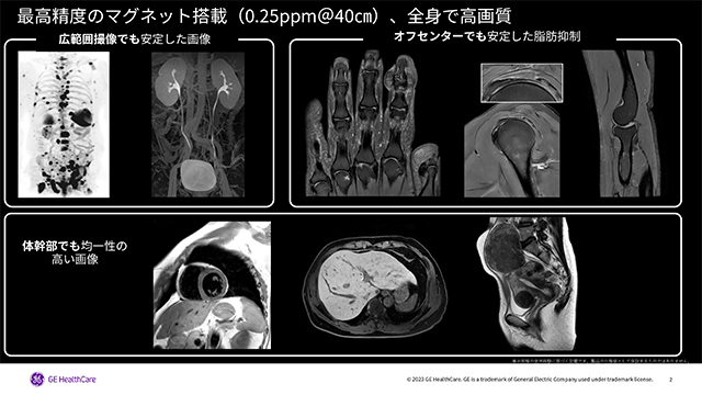 SIGNA Hero（MRI - 3.0T 超伝導型） - GEヘルスケア・ジャパン株式会社