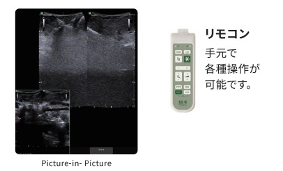 画像比較機能やリモートコントロール機能