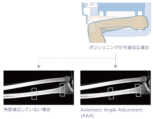 Automatic Angle Adjustment（AAA）機能