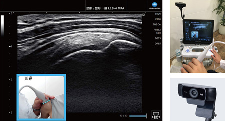 超音波画像とカメラ画像を同時表示Camera Link