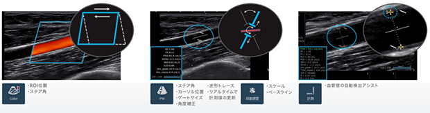 血流量の測定をアシストVascular NAVI（バスキュラーナビ）
