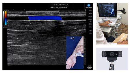 超音波画像とカメラ画像を同時表示Camera Link