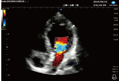 多様なシーンでの診断をサポート　セクタプローブ S4-2