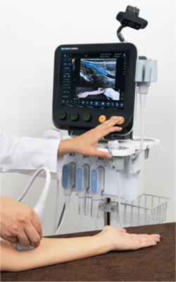 超音波画像とカメラ画像を同時表示Camera Link