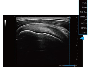≪深度：浅い≫台形走査OFF