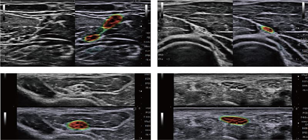 神経を可視化する VisNerve
