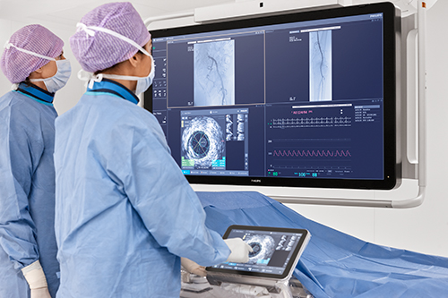 イメージングシステム「IntraSight」との統合