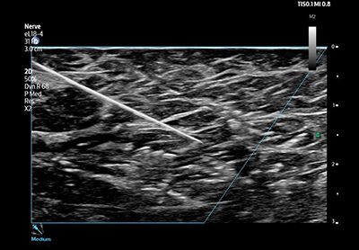 フィリップスの上位機の技術を継承した画質とアプリケーション