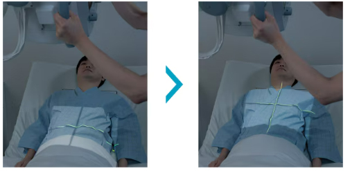 レーザーナビゲーション