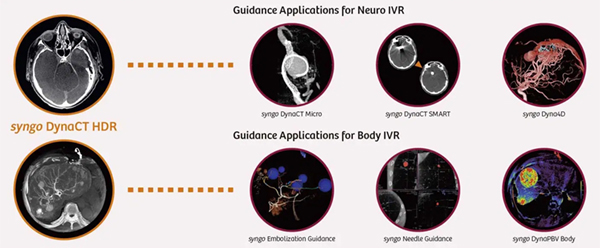 Expand Smart Image Guidance