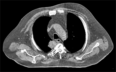 最短6秒でのCBCT撮影
