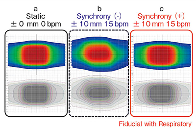 図4　Synchronyの線量精度検証：線量分布