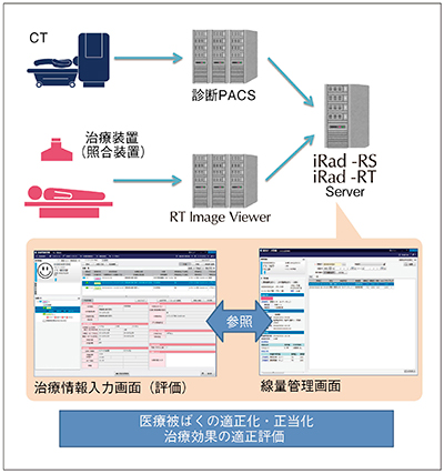 図2　iRadシリーズを活用した放射線治療における線量管理