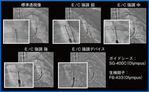 図1　Accentモード適用による視認性の向上（経気管支生検：TBLB） 強調を変えることで鉗子の視認性が向上している。