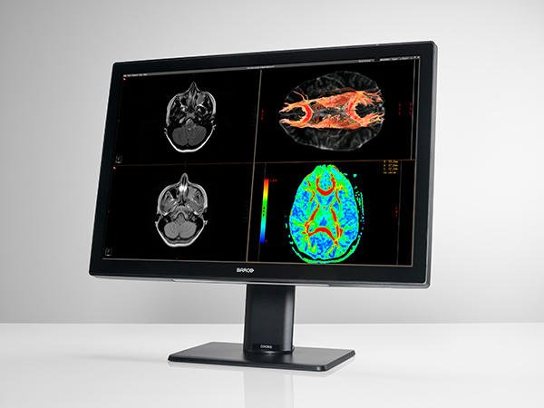 2019年に発売された“Fusionコンセプト”の最新カラーディスプレイ