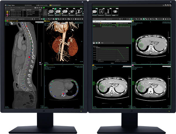 新たなAIプラットフォームとなる読影ビューワ「SYNAPSE SAI viewer」
