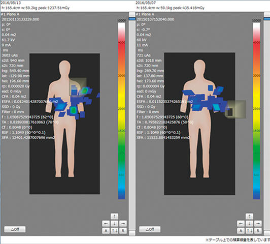 被ばく線量管理システム「DOSE MANAGER」