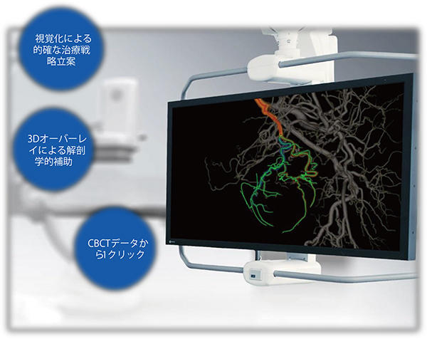 CBCT画像からワンクリックで血管を選択