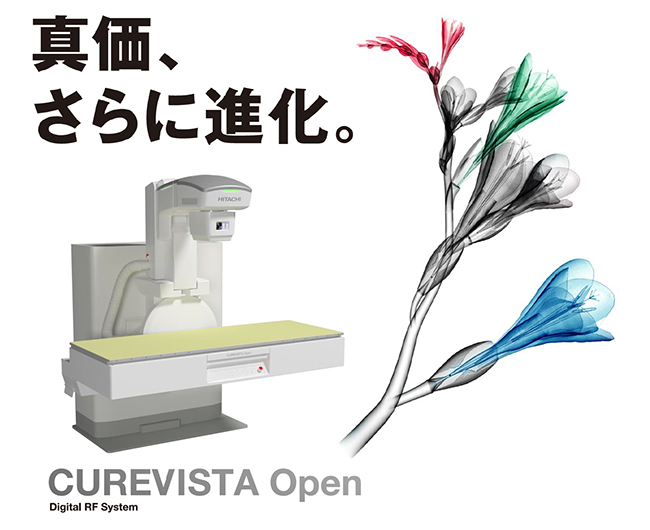 デジタルX線透視システム「CUREVISTA Open」を新発売
