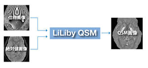 マルチベンダーのMR画像に対応する「LiLiby QSM」