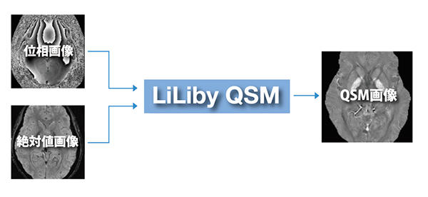 マルチベンダーのMR画像に対応する「LiLiby QSM」