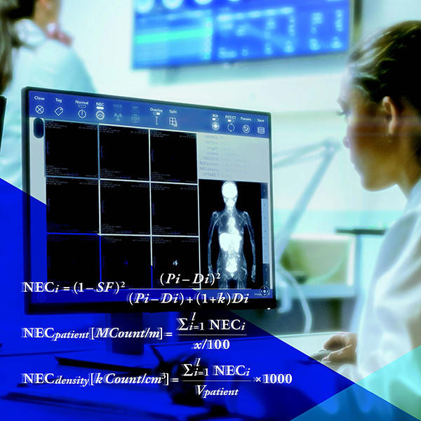 医療被ばく線量管理システム「onti」