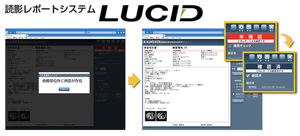 レポート見落とし防止管理機能が注目される読影レポートシステム「LUCID」