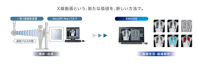 X線動画撮影システム