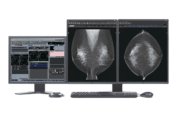 マンモグラフィ画像診断システム「FINO.View MG」