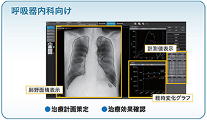 図3　呼吸器内科向け KINOSIS画面