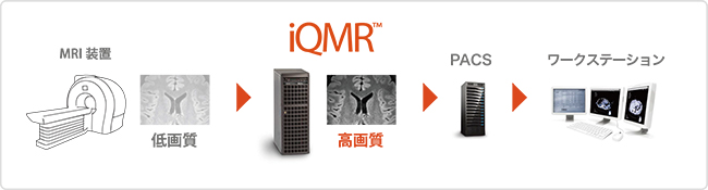 iQMRを用いた撮像時間短縮のためのデータフロー