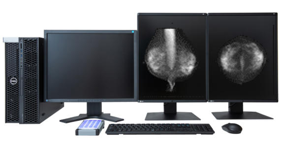 乳腺画像診断ワークステーション「mammodite」
