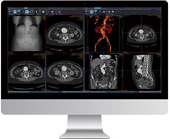 2020年1月に薬機法認証を取得したPACS製品「Vue PACS」