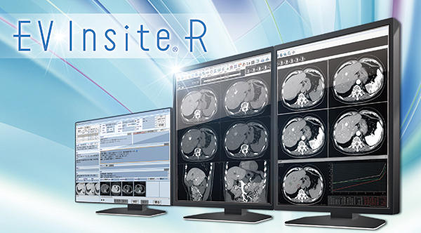 読影用ビューアーソフトウェア「EV Insite R」