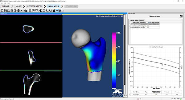 3D-SHAPERの解析結果画面例