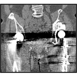 「iDose4 Premium Package」なし