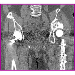 「iDose4 Premium Package」あり