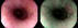 白色光による観察画像（左）OEによる観察画像（右）（血管が強調されている）  臨床画像提供：東京大学医学部附属病院　小田島　慎也氏，藤城　光弘氏 （画像は一例であり，OEによる効果を常に保証するものではない。）