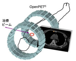 OpenPET®のイメージ図