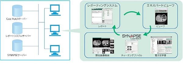 放射線読影レポートシステムとSYNAPSEを組み合わせた場合の運用構成例