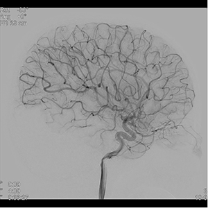 15インチ側面FPDの十分なカバレージ