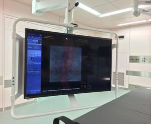 3D CTのフュージョン画像（InnovaVision）を映し出すモニター