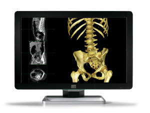 Coronis Fusion 4MP LED（MDCC-4230）