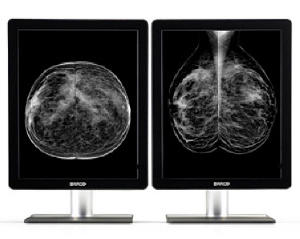 Nio 5MP LED（MDNG-5221）