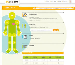 「カルテコ」イメージ