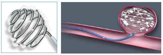 Interlock インターロック