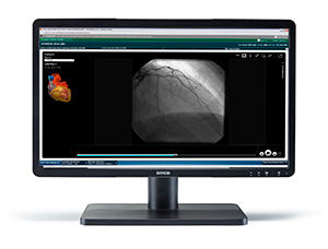 MDRC-2122 TS（EONIS22 TS）