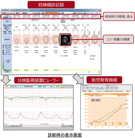診断時の表示画面